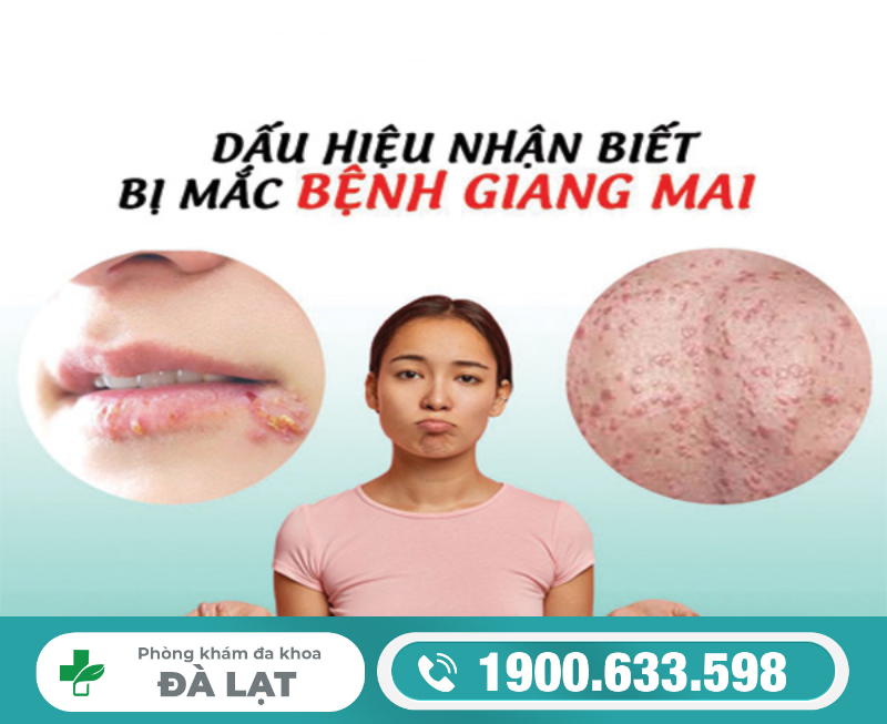 Hình ảnh minh họa